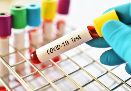 Trhák světového zákulisí: "Pozor, test na COVID -19 je infikován!"