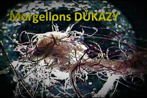 americka-cdc-uznala-morgellony-ako-skutocnu-chorobu